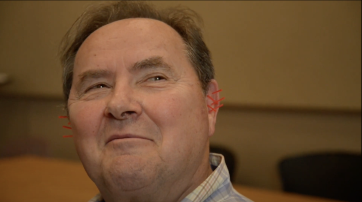 man smiling with needles in ears